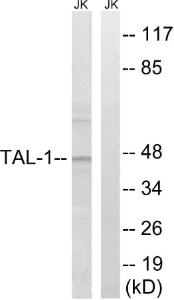 Western blot analysis of lysates from Jurkat cells, treated with PMA 125ng/ml 30' using Anti-TAL-1 Antibody. The right hand lane represents a negative control, where the antibody is blocked by the immunising peptide