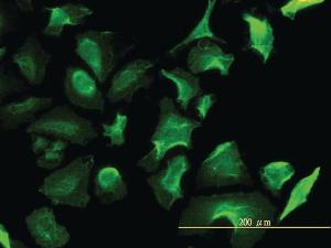 Anti-LDHB Mouse Monoclonal Antibody [clone: 2H6]