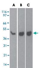 Anti-CASP7 Mouse Monoclonal Antibody [clone: 25B881.1]