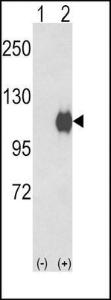 Anti-ENPP2 Rabbit Polyclonal Antibody (Biotin)