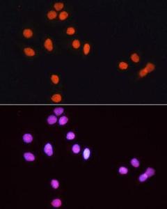 Immunofluorescence analysis of HeLa cells, using Goat Anti-Rabbit IgG H&L Antibody (TRITC, (A17346) as the primary Antibody at a dilution of 1:100. The cells were incubated with the primary Antibody overnight at 4 °C.