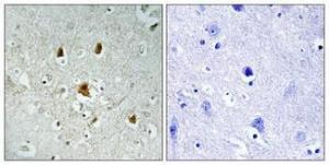 Immunohistochemical analysis of paraffin-embedded human brain using Anti-Abl (phospho Tyr204) Antibody 1:100 (4°C overnight). The right hand panel represents a negative control, where the antibody was pre-incubated with the immunising peptide.