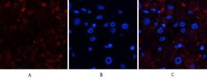 Immunofluorescence analysis of human kidney cancer tissue using Anti-CAT Antibody (red) at 1:200 (4 °C overnight). Cy3 labelled secondary Antibody was used at 1:300 (RT 50 min). Panel A: Target. Panel B: DAPI. Panel C: Merge