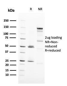 SDS-PAGE analysis of Anti-HER2 Antibody [ERBB2/3093] under non-reduced and reduced conditions; showing intact IgG and intact heavy and light chains, respectively. SDS-PAGE analysis confirms the integrity and purity of the antibody