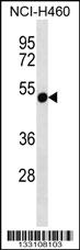 Anti-RTDR1 Rabbit Polyclonal Antibody