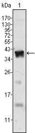 Anti-AR Mouse monoclonal antibody unconjugated [clone: 2H8]