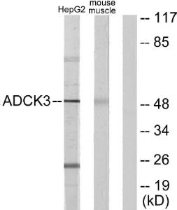 Western blot analysis of lysates from HepG2 and mouse muscle cells using Anti-ADCK3 Antibody. The right hand lane represents a negative control, where the antibody is blocked by the immunising peptide