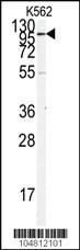 Anti-ACE2 Rabbit Polyclonal Antibody