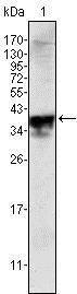 Anti-AR Mouse monoclonal antibody unconjugated [clone: 2H8]