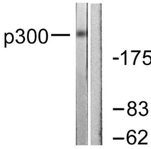 Western blot analysis of lysates from MDA-MB-435 cells using Anti-p300 Antibody. The right hand lane represents a negative control, where the antibody is blocked by the immunising peptide