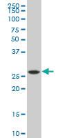 Anti-PNPO Mouse Polyclonal Antibody