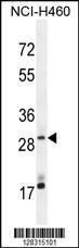 Anti-MAGIX Rabbit Polyclonal Antibody (AP (Alkaline Phosphatase))