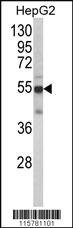 Anti-CYP2J2 Rabbit Polyclonal Antibody