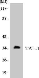 Western blot analysis of the lysates from HT 29 cells using Anti-TAL-1 Antibody