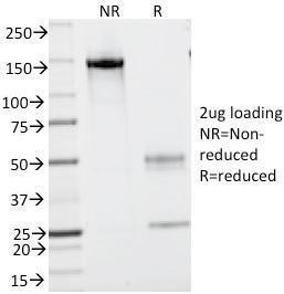 SDS-PAGE analysis of Anti-CD43 Antibody [SPN/839] under non-reduced and reduced conditions; showing intact IgG and intact heavy and light chains, respectively. SDS-PAGE analysis confirms the integrity and purity of the antibody