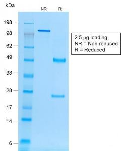 SDS-PAGE analysis of Anti-EpCAM Antibody [rVU-1D9] under non-reduced and reduced conditions; showing intact IgG and intact heavy and light chains, respectively. SDS-PAGE analysis confirms the integrity and purity of the antibody