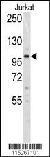 Anti-DNMT3A Rabbit Polyclonal Antibody