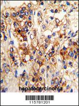 Anti-CYP2J2 Rabbit Polyclonal Antibody