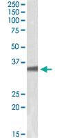 Anti-GNB3 Goat Polyclonal Antibody