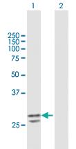 Anti-PNPO Mouse Polyclonal Antibody