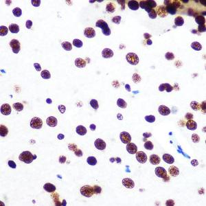 Immunohistochemistry analysis of paraffin-embedded mouse brain using Anti-SFPQ Antibody [ARC0788] (A307412) at a dilution of 1:100 (40X lens). Perform microwave antigen retrieval with 10 mM PBS buffer pH 7.2 before commencing with IHC staining protocol