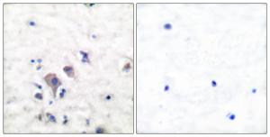 Anti-mGluR2 and mGluR3 antibody