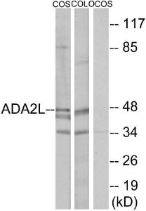 Western blot analysis of lysates from COS7 and COLO205 cells using Anti-ADA2L Antibody. The right hand lane represents a negative control, where the antibody is blocked by the immunising peptide