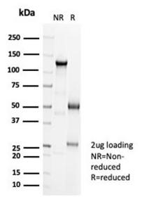 SDS-PAGE analysis of Anti-Cadherin 16 Antibody [CDH16/7027R] under non-reduced and reduced conditions; showing intact IgG and intact heavy and light chains, respectively SDS-PAGE analysis confirms the integrity and purity of the antibody