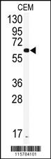 Anti-CYP2J2 Rabbit Polyclonal Antibody