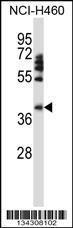 Anti-FOXD1 Rabbit Polyclonal Antibody (Biotin)