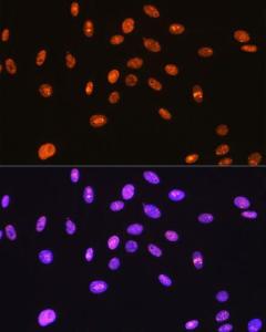 Immunofluorescence analysis of C6 cells using Anti-SFPQ Antibody [ARC0788] (A307412) at a dilution of 1:100 (40X lens). DAPI was used to stain the cell nuclei (blue)