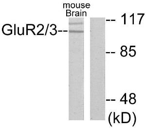 Anti-mGluR2 and mGluR3 antibody