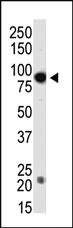 Anti-DNMT3B Rabbit Polyclonal Antibody