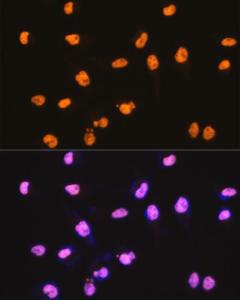 Immunofluorescence analysis of HeLa cells using Anti-SFPQ Antibody [ARC0788] (A307412) at a dilution of 1:100 (40X lens). DAPI was used to stain the cell nuclei (blue)