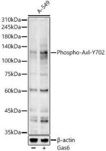 Western blot analysis of A-549, using Goat Anti-Mouse IgG H&L Antibody (AP) (A17348) at 1:400 dilution. A-549 cells were treated by Gas6 (400 ng/ml) at 37°C for 5 minutes. The secondary antibody was Goat Anti-Rabbit IgG H&L Antibody (HRP) at 1:10,000 dilution.