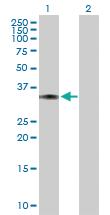 Anti-LDHC Mouse Polyclonal Antibody