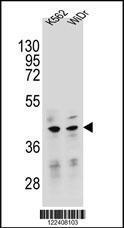 Anti-TFB2M Rabbit Polyclonal Antibody