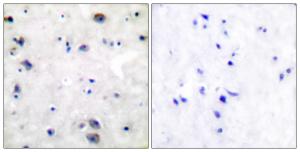 Immunohistochemical analysis of paraffin-embedded human brain tissue using Anti-Opioid Receptor Antibody The right hand panel represents a negative control, where the antibody was pre-incubated with the immunising peptide