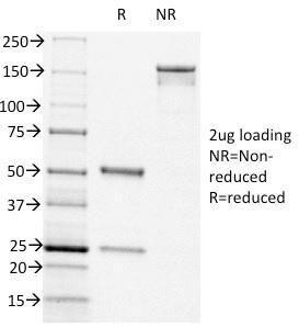 SDS-PAGE analysis of Anti-CD44v6 Antibody [CD44v6/1246] under non-reduced and reduced conditions; showing intact IgG and intact heavy and light chains, respectively. SDS-PAGE analysis confirms the integrity and purity of the Antibody