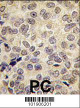 Anti-DNMT3B Rabbit Polyclonal Antibody