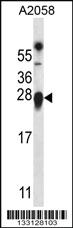 Anti-TMED9 Rabbit Polyclonal Antibody