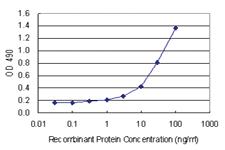 Anti-IFI16 Polyclonal Antibody Pair