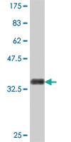 Anti-ERCC1 Mouse Polyclonal Antibody