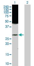 Anti-RAB43 Rabbit Polyclonal Antibody