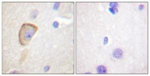 Immunohistochemical analysis of paraffin-embedded human brain using Anti-Opioid Receptor Antibody 1:100 (4°C overnight) The right hand panel represents a negative control, where the antibody was pre-incubated with the immunising peptide