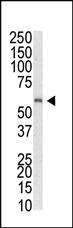 Anti-MBD1 Rabbit Polyclonal Antibody