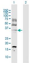 Anti-LDHC Rabbit Polyclonal Antibody