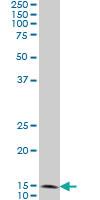 Anti-FIS1 Mouse Monoclonal Antibody [clone: 1G9]