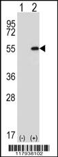 Anti-HLA-DPB1 Rabbit Polyclonal Antibody