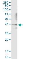 Anti-LDHC Rabbit Polyclonal Antibody